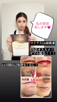 GLOSS 京都/烏丸御池 脱毛・エステサロン 사진 2