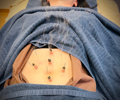 烏丸御池 樹美容鍼灸整体院 사진 2