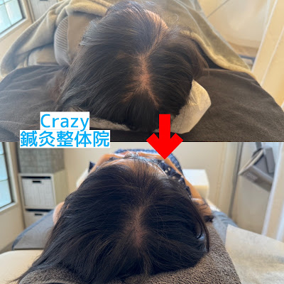 Crazy鍼灸整体院 烏丸御池院 사진 4