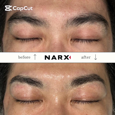 中島式メンズ脱毛サロン NARX ナークス 사진 4