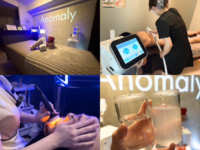 Anomaly 사진 5