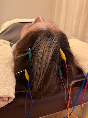 Kiyotaseikotsuin Yuyamahonin ×kiyota Acupuncture 사진 2