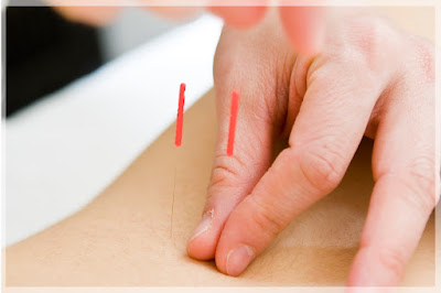 Tanpopo Acupuncture 사진 2